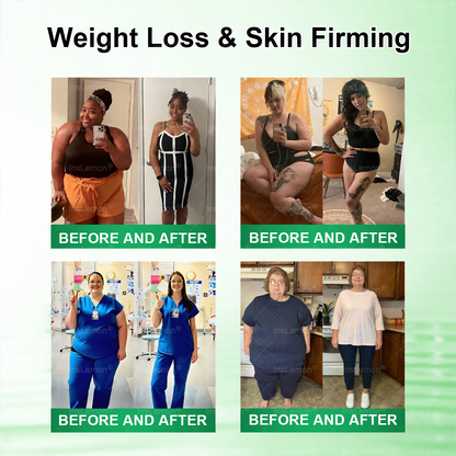 🌟𝐈𝐧𝐬𝐋𝐞𝐦𝐨𝐧® 𝗠𝗼𝗿𝗶𝗻𝗴𝗮 × 𝗕𝗲𝗿𝗯𝗲𝗿𝗶𝗻𝗲 × 𝗔𝗠𝗣𝗞 𝟭𝟬-𝗶𝗻-𝟭 𝗠𝗲𝘁𝗮𝗯𝗼𝗹𝗶𝗰 𝗦𝘂𝗽𝗽𝗼𝗿𝘁 𝗡𝗮𝗻𝗼 𝗠𝗶𝗰𝗿𝗼𝗻𝗲𝗲𝗱𝗹𝗲 𝗣𝗮𝘁𝗰𝗵(𝐉𝐮𝐬𝐭 𝐨𝐧𝐜𝐞 𝐚 𝐝𝐚𝐲, 𝐯𝐢𝐬𝐢𝐛𝐥𝐞 𝐜𝐡𝐚𝐧𝐠𝐞𝐬 𝐢𝐧 𝟕 𝐝𝐚𝐲𝐬） ✅ 𝐅𝐨𝐫 𝐨𝐛𝐞𝐬𝐢𝐭𝐲, 🅛🅞🅞🅢🅔 🅢🅚🅘🅝,𝐝𝐢𝐚𝐛𝐞𝐭𝐞𝐬, 𝐬𝐥𝐞𝐞𝐩 𝐚𝐩𝐧𝐞𝐚, 𝐣𝐨𝐢𝐧𝐭 𝐢𝐬𝐬𝐮𝐞𝐬, 𝐚𝐧𝐝 𝐦𝐨𝐫𝐞